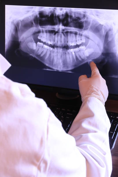 Best Emergency Denture Repair in Des Plaines, IL