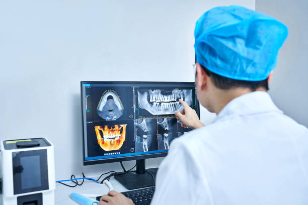 Best Emergency Wisdom Teeth Removal in Des Plaines, IL