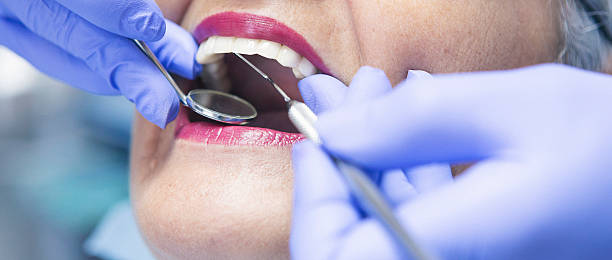 Best Emergency Treatment for Dental Infections or Abscesses in Des Plaines, IL